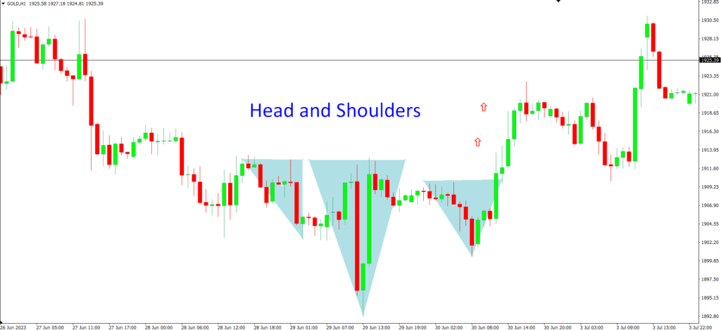 Head and Shoulders